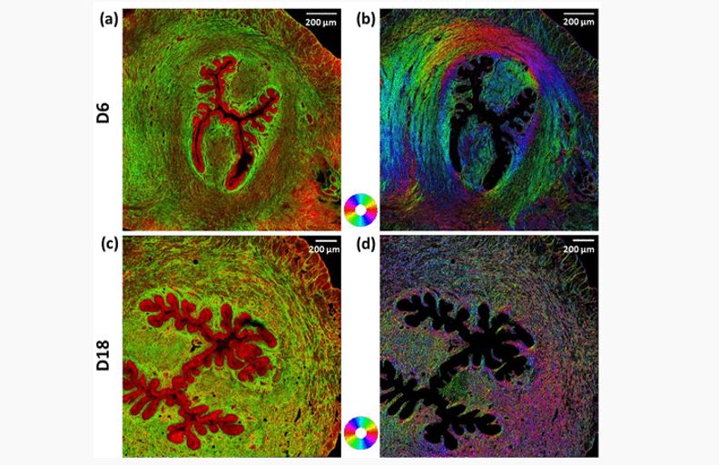 Quantitative Assessment of Collagen Remodeling during a Murine ...